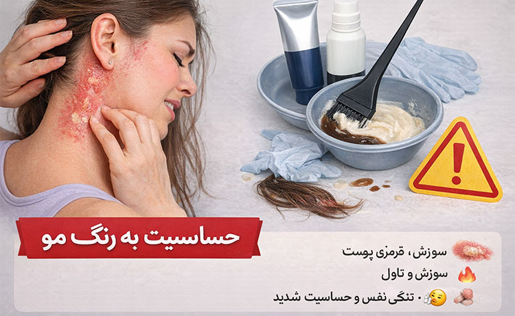 تست رنگ مو حساسیت