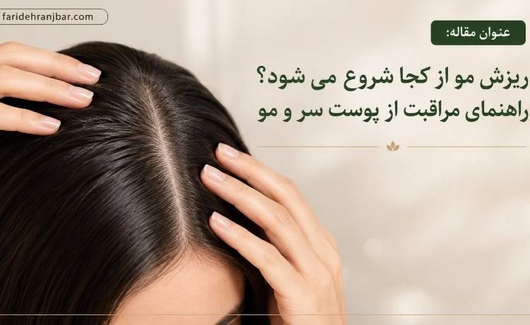 ریزش مو از کجا شروع می‌شود؟ راهنمای مراقبت از پوست سر و مو